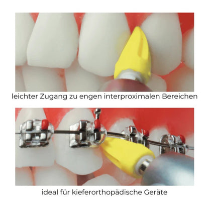 Silikon-Polierspitzen CA-Schaft, spitz & geriffelt, mittel, latexfrei 100 St. / Pck.